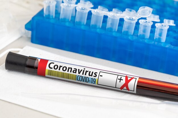 Photo positive coronavirus blood test tube laying on lab table