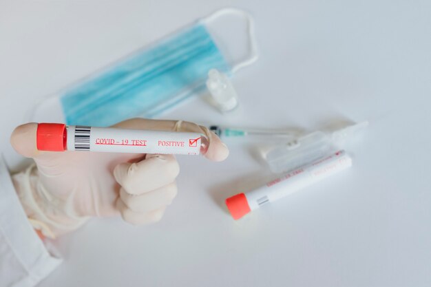 Фото Положительный тест на коронавирус в руке врача. 2020 апрель
