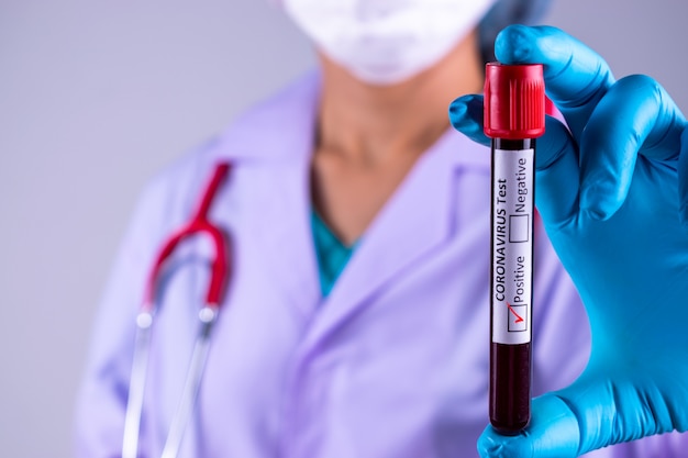 Positive COVID-19 test and laboratory sample of blood testing for diagnosis Corona virus infection.