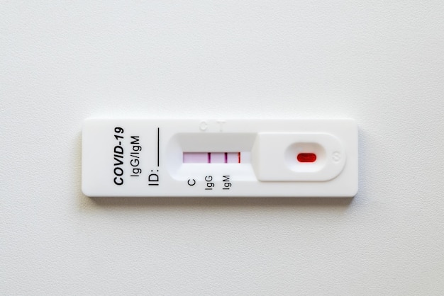 흰색 배경에 누워 긍정적인 COVID19 SARSCoV2 항원 빠른 테스트