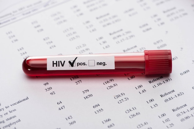 紙の結果フォームで陽性の HIV 血液サンプル検査