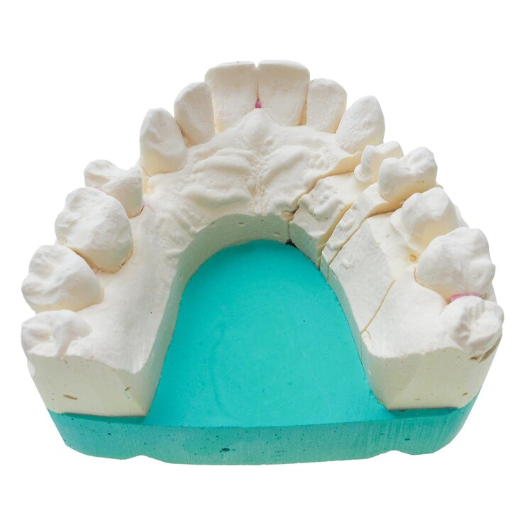 Positive teeth cast