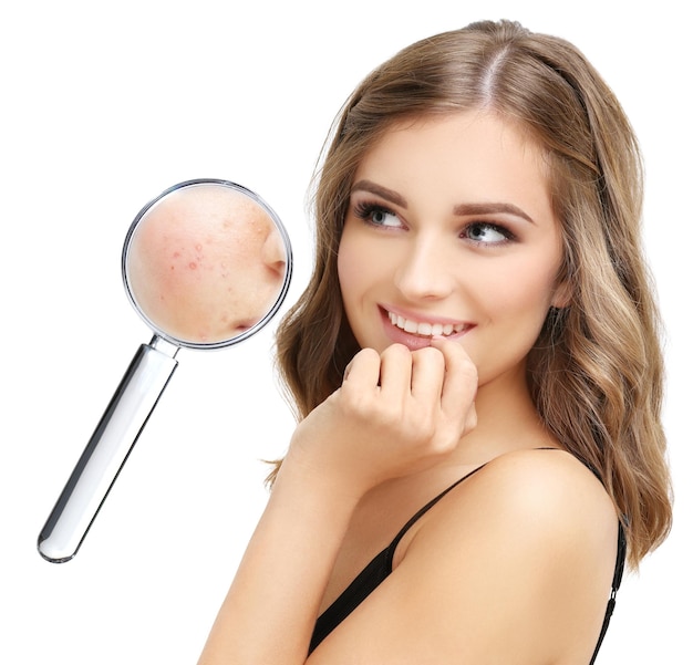 Post Acne Marks Behandeling van Acne Littekens Acne Litteken Verwijdering