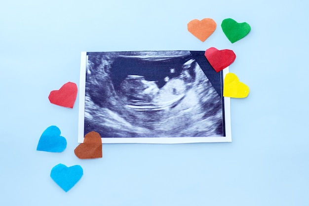 pregnancy and baby waiting concept ultrasound picture with fetus in uterus and a white ceramic hear