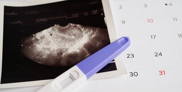 Photo pregnancy test with ultrasound scan photo of fetus maternity childbirth birth control