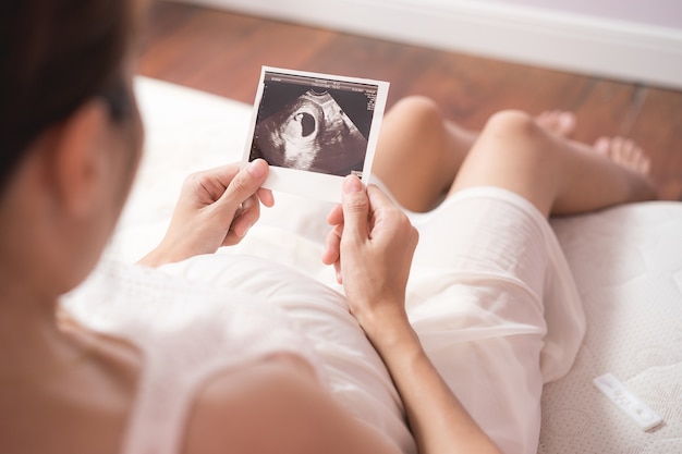 Беременная женщина Азии, глядя на ультразвуковое сканирование ребенка