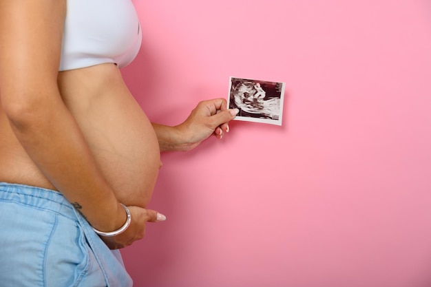 妊娠中のお母さんが息子の超音波検査をしている