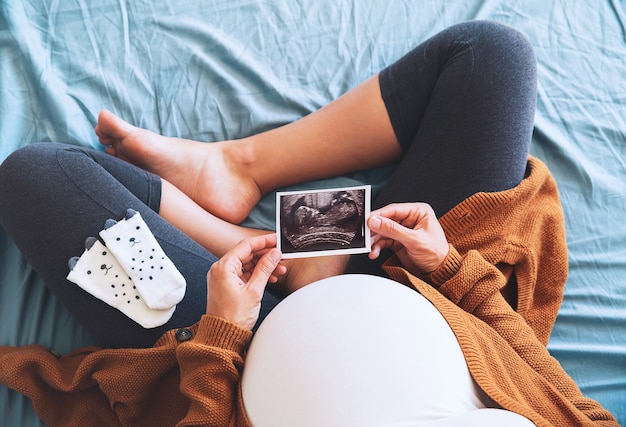 Photo pregnant woman holding ultrasound image concept of pregnancy health care gynecology medicine