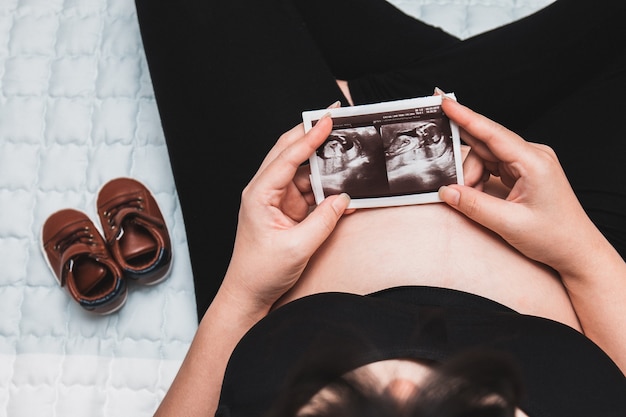 Беременная женщина, держащая ультразвуковое изображение. Мать ждет ребенка.