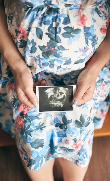 写真 赤ちゃんの超音波画像を示す妊婦