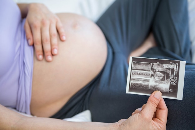 Pregnant woman showing ultrasound scan on bed