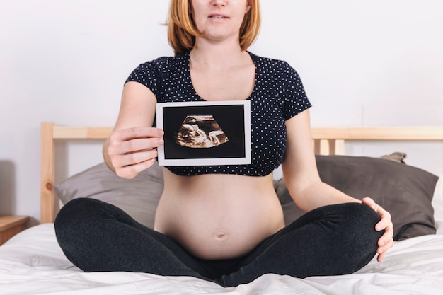 Photo pregnant woman showing ultrasound