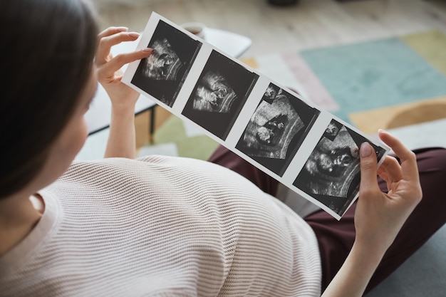 pregnant woman sitting on sofa with x-ray images she looking at ultrasound of her baby