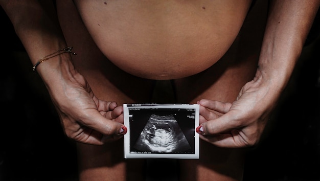 Foto donna incinta con l'immagine di scansione di ultrasuono