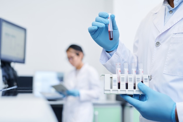 Preparing medical sample for virus research