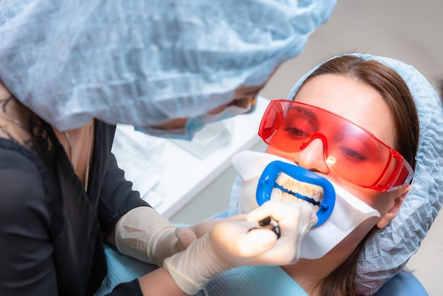 Preparing the oral cavity for whitening with an ultraviolet lamp Closeup