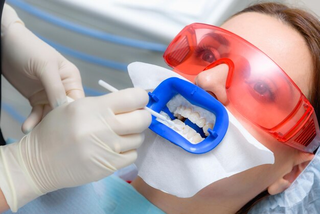 Preparing the oral cavity for whitening with an ultraviolet\
lamp closeup