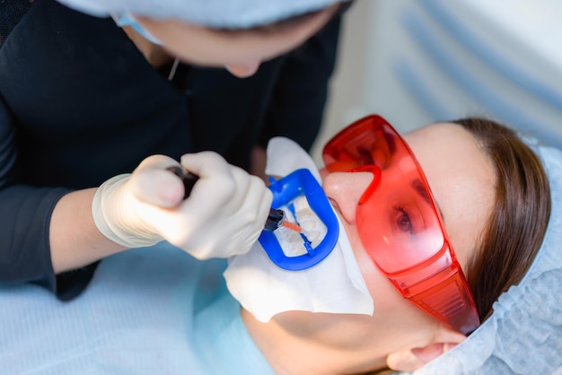 Preparing the oral cavity for whitening with an ultraviolet lamp Closeup