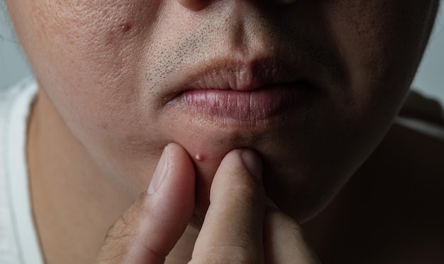 Looking to cover scars, veins or blemishes? Body makeup might be the answer  - Good Morning America