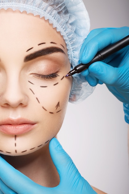 Pretty girl with dark eyebrows wearing blue medical hat at  wall, doctor's hands wearing blue gloves drawing perforation lines on face, plastic surgery concept.