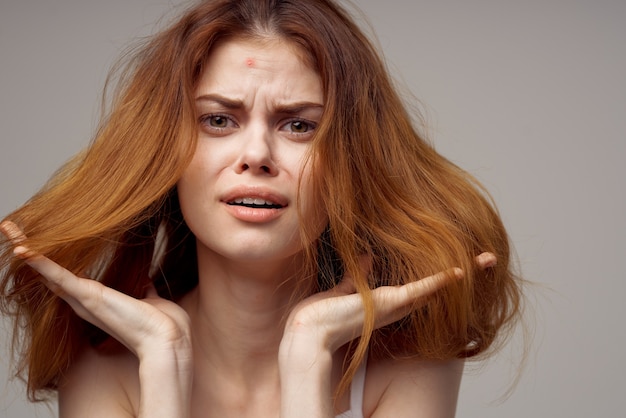 Pretty woman in a white tshirt pimples on the face isolated\
background