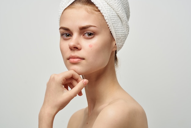 Pretty woman with a pimple on the face dermatology isolated\
background