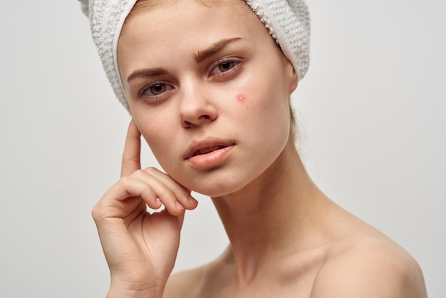 Pretty woman with a pimple on the face dermatology isolated\
background