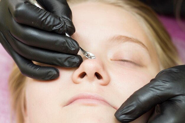 Procedure for cleaning skin with steel tool from blackheads and\
acne. deep cleansing of the female face with blackhead remover in\
the beauty salon. cosmetologist making receiving cleansing\
therapy