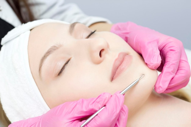 Procedure for cleaning skin with steel tool from blackheads and
acne deep cleansing of the female face with blackhead remover in
the beauty salon cosmetologist making receiving cleansing
therapy