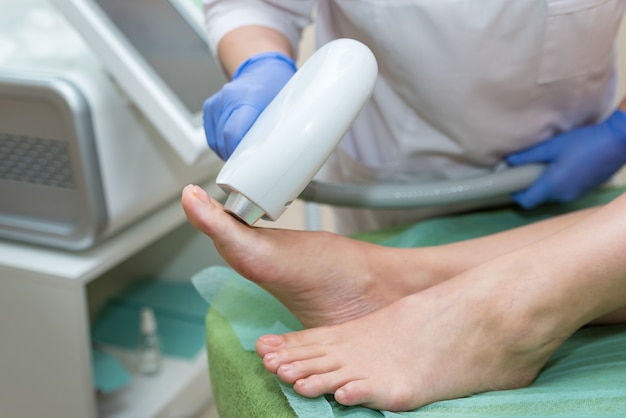 Procedure for laser hair removal from legs