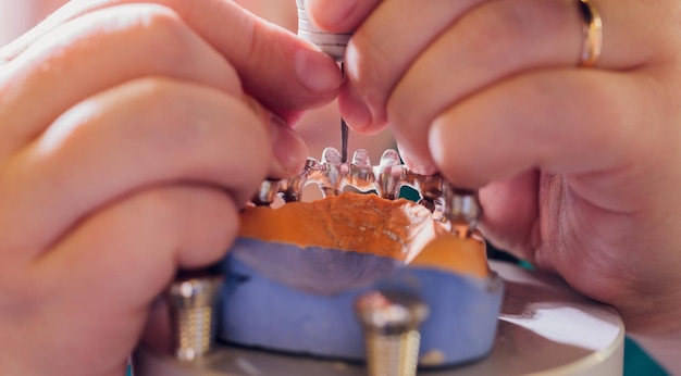 The process of making a dental prosthesis in a dental laboratory