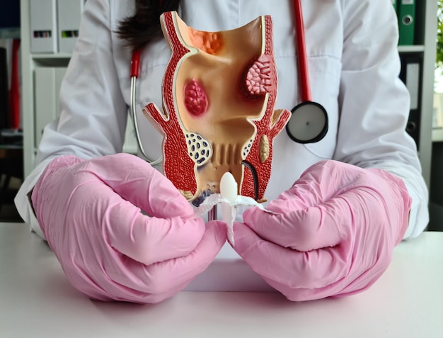 人間の直腸の人工モデルに直腸坐剤を挿入する肛門科医の医師