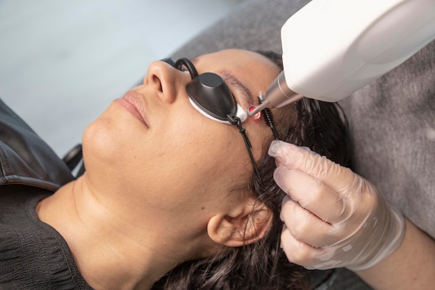 A professional applying a laser to a woman's face to remove a tattoo on her eyebrow