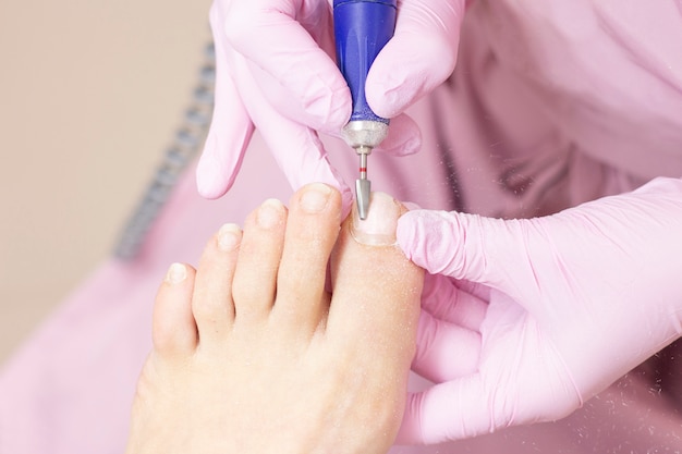 Professional hardware pedicure using an electric machine. Patient at the pedicure procedure. polishing the nail plate, processing the cuticle using a pedicure machine.