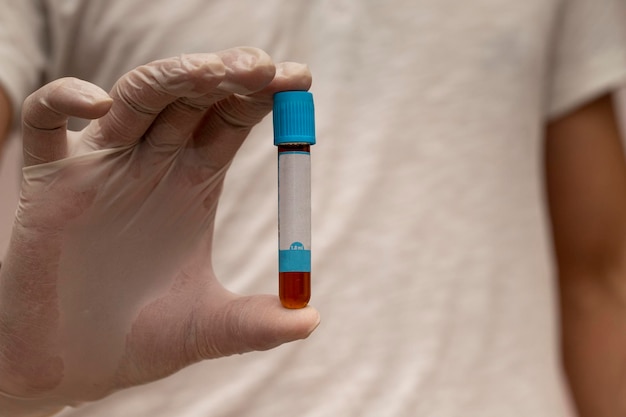 professional man scientist is showing blood test tube with confidence
