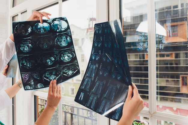 Professional medical team examining patients medical records and xray brain xray