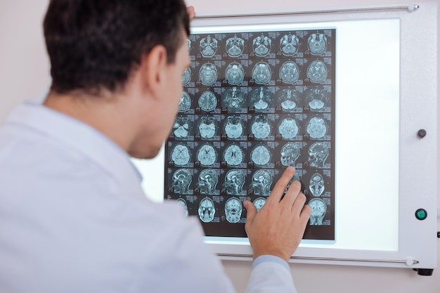 Профессиональный серьезный врач-мужчина стоит перед изображением Z-ray и смотрит на него, ставя диагноз