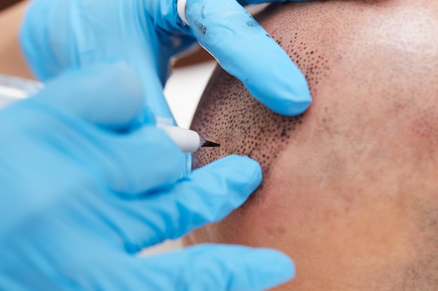 Professional tattooist making permanent make up tricopigmentation