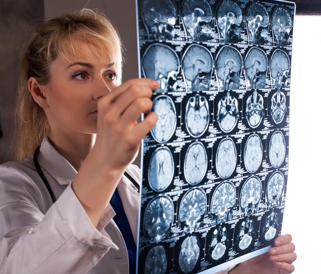 Foto giovane dottoressa professionista in camice bianco che tiene la risonanza magnetica del cervello umano e lo guarda