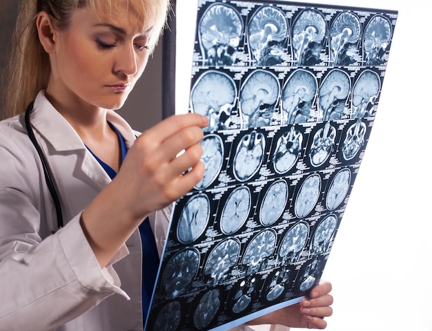 Professional young doctor woman in white labcoat holding mri of human brain and looking at it