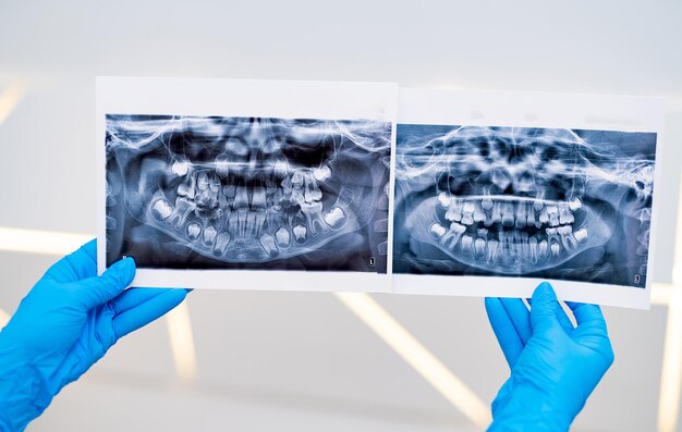 Professionele röntgenscreening van tanden Diagnose van moderne tandheelkundige technologieën