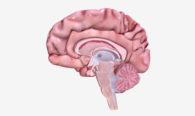 Photo progression of multiple sclerosis sagittal view