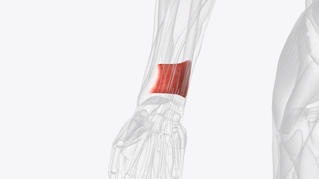 Photo pronator quadratus is a squareshaped muscle on the distal forearm that acts to pronate the hand