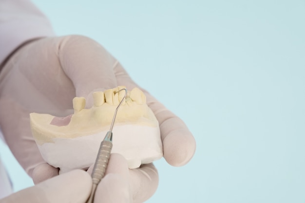 Prosthodontics or Prosthetic / Crown and bridge equipment and model express fix restoration.