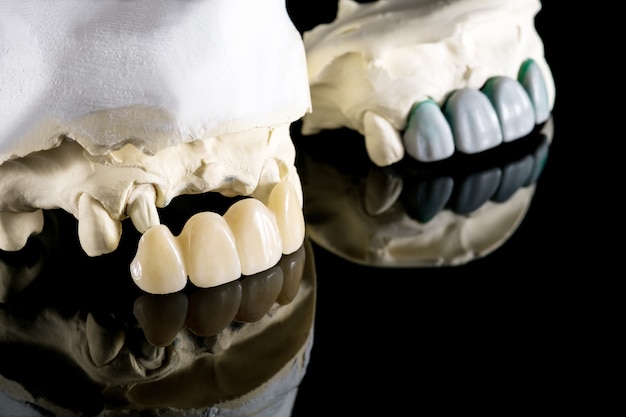 Photo prosthodontics or prosthetic