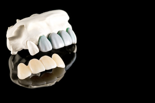 Photo prosthodontics or prosthetic