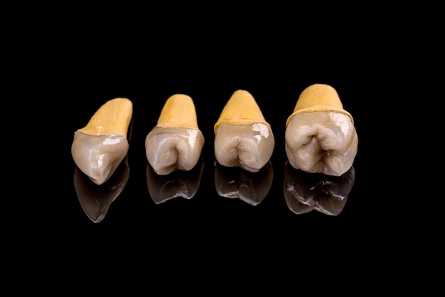 Prothetische tanden