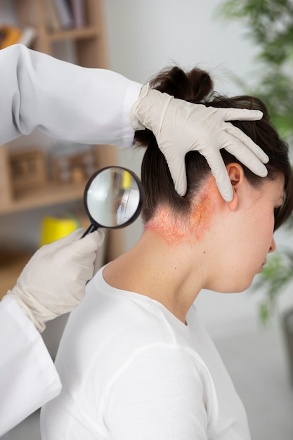 Psoriasis eczema on neck of patient