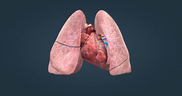 A pulmonary embolism is a blocked blood vessel in your lungs