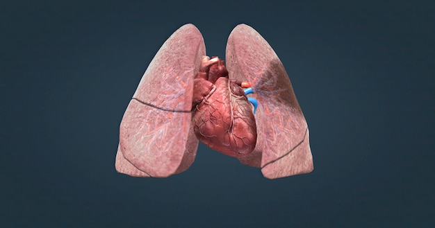 A pulmonary embolism is a blocked blood vessel in your lungs